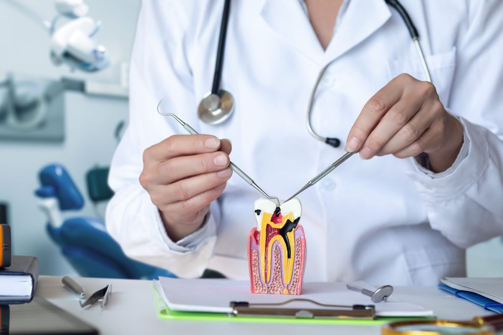 surgery over wisdom tooth extraction